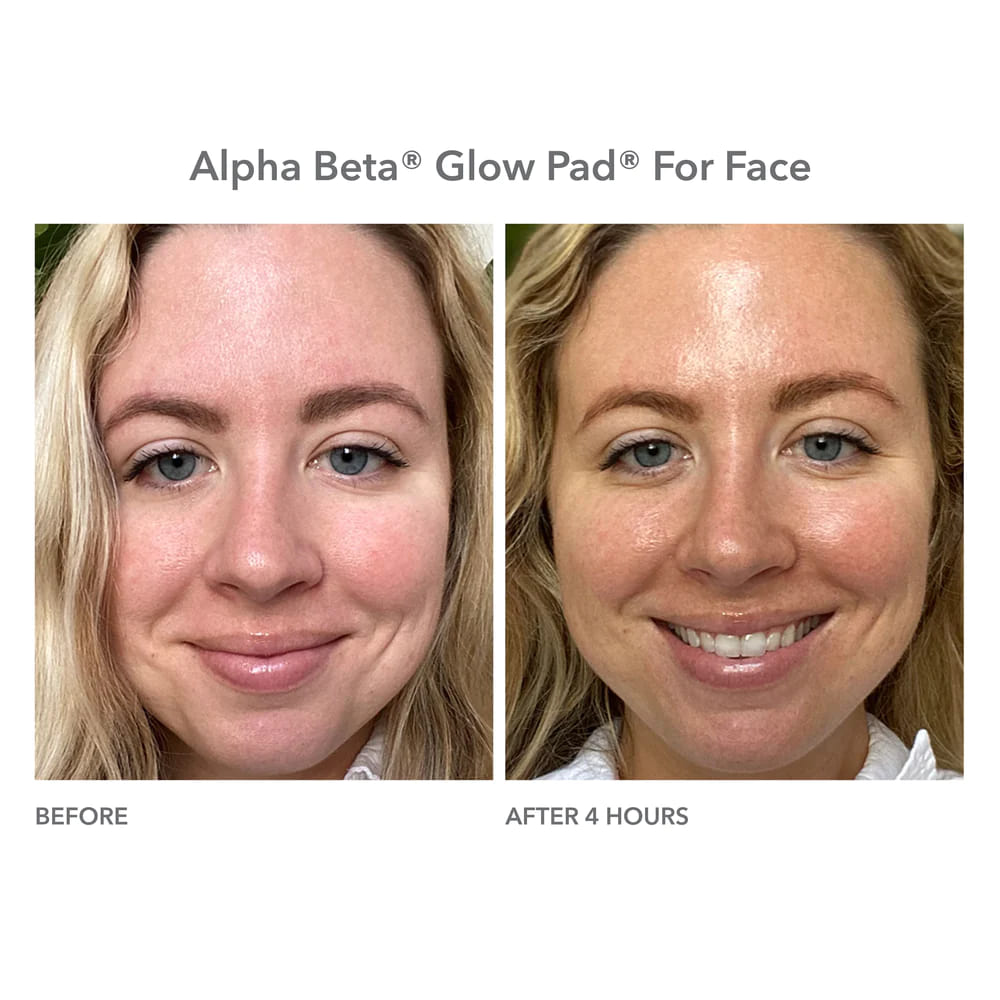 alpha-beta-glow-pad-for-face-intense-glow_5